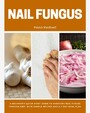 Nail Fungus - A Beginner's Quick Start Guide to Managing Nail Fungus Through Diet, With Sample Recipes and a 7-Day Meal Plan